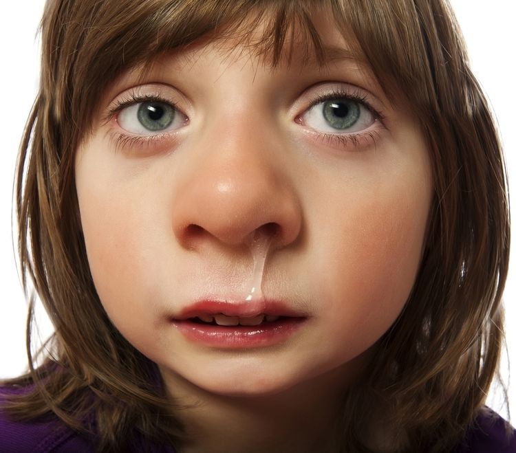 Photo of a Girl with Runny Nose