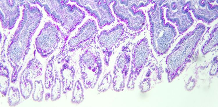 Image of small intestine wall, villi and crypts