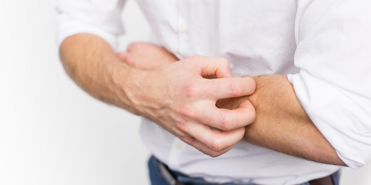 Photo of a man scratching arm