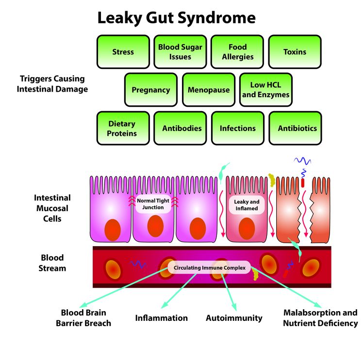 Leaky Gut Syndrome